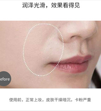 Newface射频美容仪